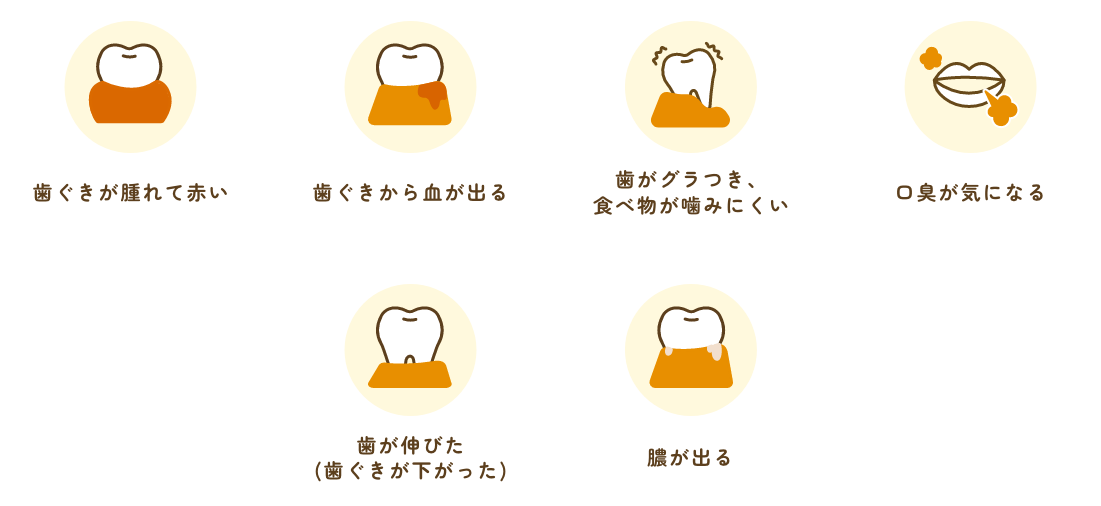 歯周病の症状イメージ